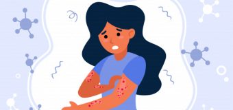 Polen Alerjisi Nedir? Neden Olur?